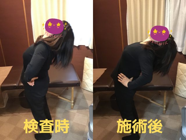 慢性腰痛の改善