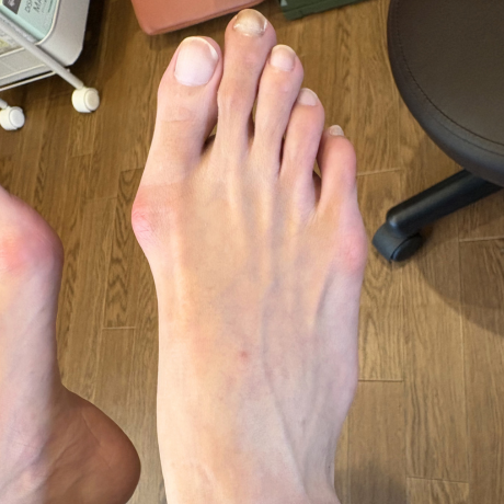 before画像