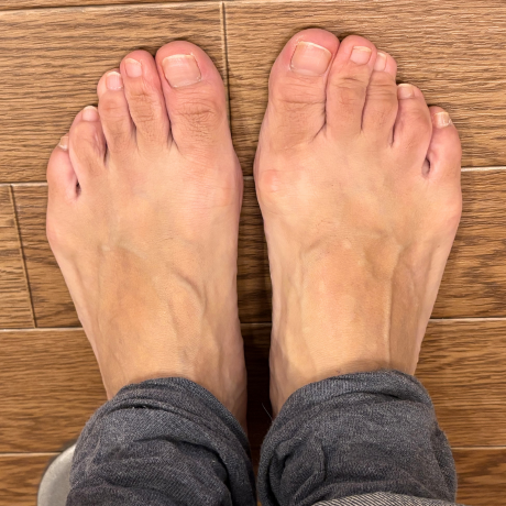 before画像